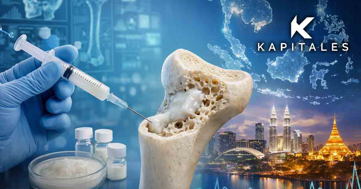 Osteopore Secures Distribution Rights for Injectable Regenerative Bone Filler in Southeast Asia